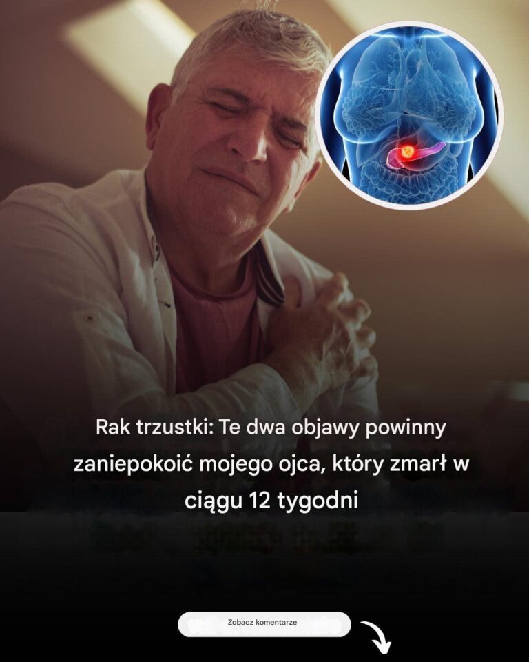 Rak_trzustki__dwa_wczesne_objawy_cz_sto__miertelnego_nowotworu