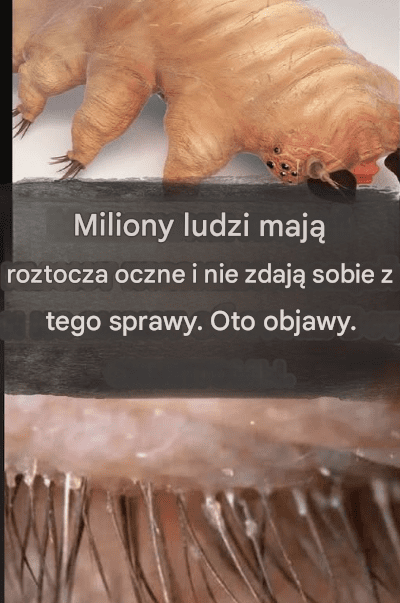 Roztocza_rz_s__jak_je_rozpozna__i_si__ich_pozby__ Roztocza_rz_s__jak_je_rozpozna__i_si__ich_pozby__
