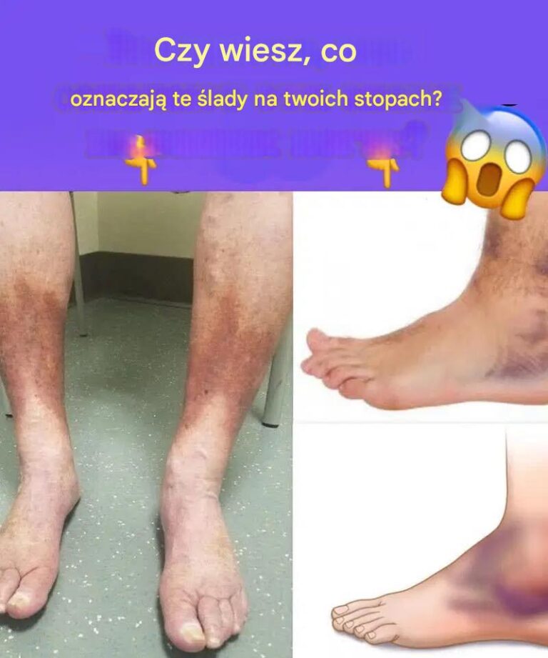 S_abe_kr__enie__objawy__przyczyny_i_leczenie_