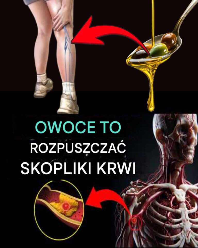Seniorzy__Te_6_codziennych_owoc_w_pomaga_utrzyma__prawid_owy_przep_yw_krwi__Lekarze_zwracaj__na_to_uwag__
