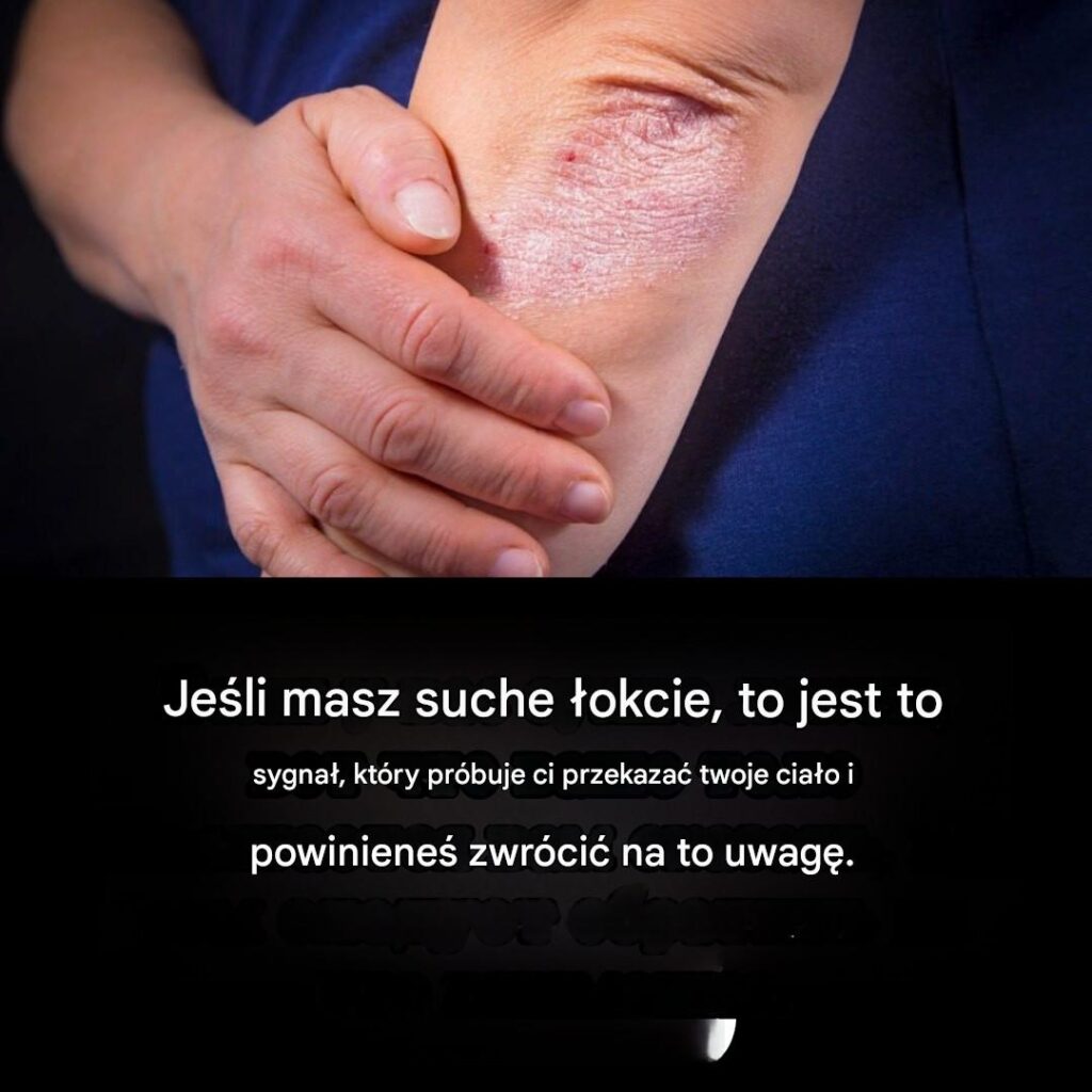 Suche__okcie__typowy_objaw_czy_powa_ny_sygna__ostrzegawczy_
