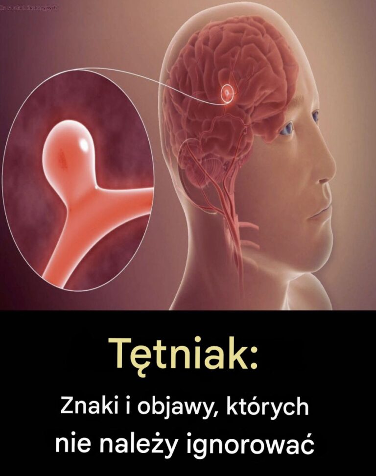 T_tniak__objawy__kt_rych_nie_nale_y_ignorowa_