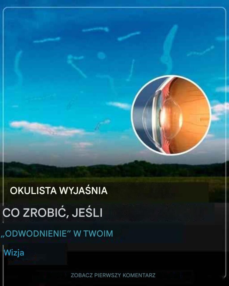 Te_dziwne_cienie_w_polu_widzenia__co_tak_naprawd__oznaczaj__plamy_oczne_i_kiedy_nale_y_si__martwi_