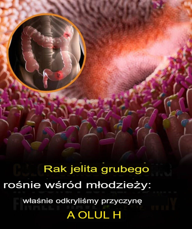 W_ko_cu_mamy_odpowied__na_rosn_c__liczb__zachorowa__na_raka_jelita_grubego_w_r_d_m_odych_doros_ych