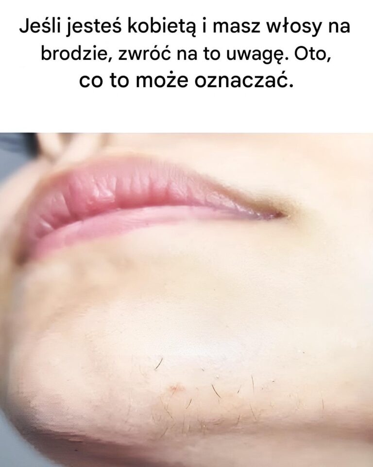 W_osy_na_brodzie_u_kobiet__co_to_oznacza_