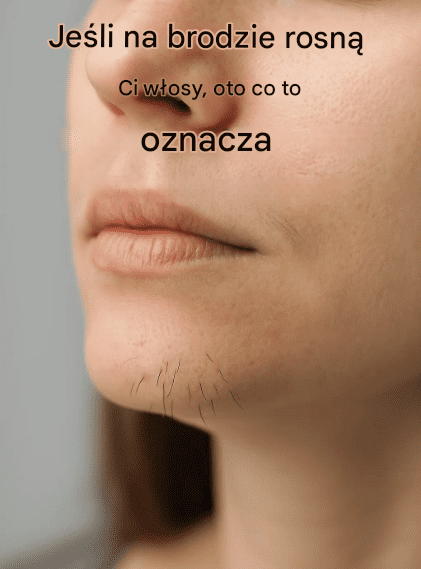 W_osy_na_brodzie_u_kobiet__sygna__p_yn_cy_z_cia_a_ W_osy_na_brodzie_u_kobiet__sygna__p_yn_cy_z_cia_a_