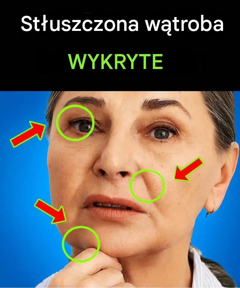 Wszyscy_ze_st_uszczeniem_w_troby_maj__to_samo__Ukryty_objaw__o_kt_rym_powiniene__wiedzie__ Wszyscy_ze_st_uszczeniem_w_troby_maj__to_samo__Ukryty_objaw__o_kt_rym_powiniene__wiedzie__