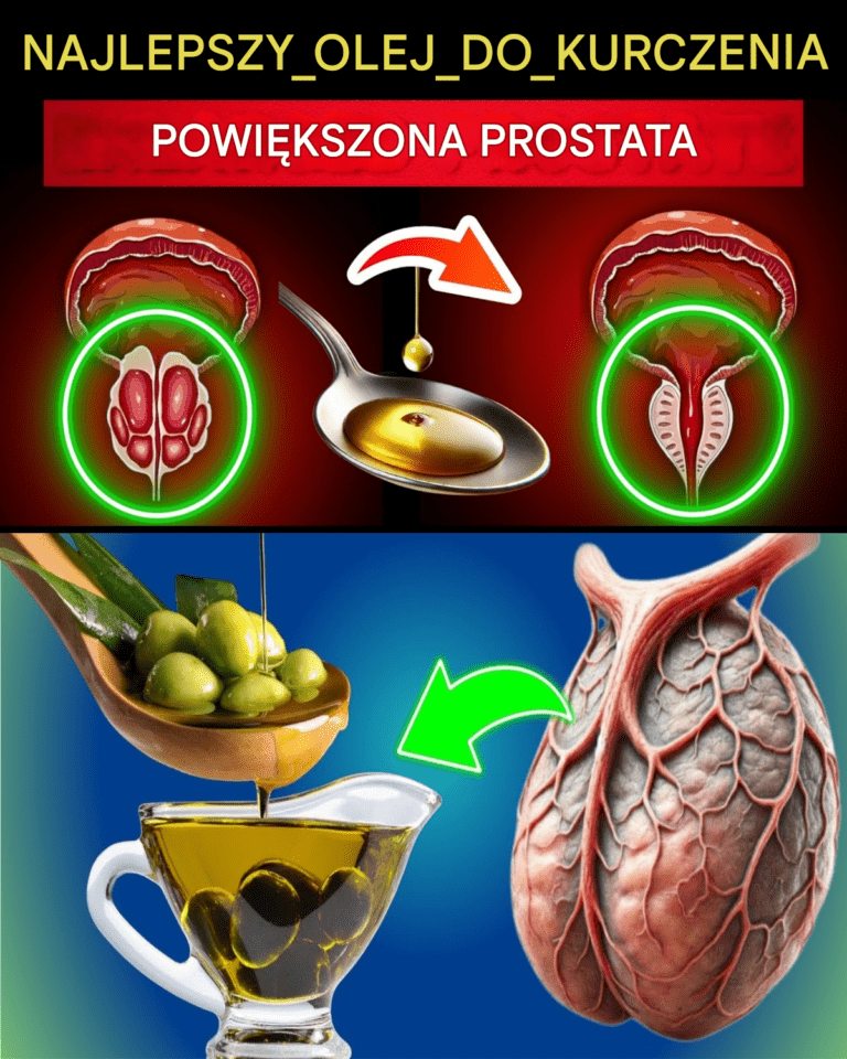 Zmniejsz_prostat__w_naturalny_spos_b__6_najlepszych_olejk_w__kt_rych_musisz_spr_bowa_