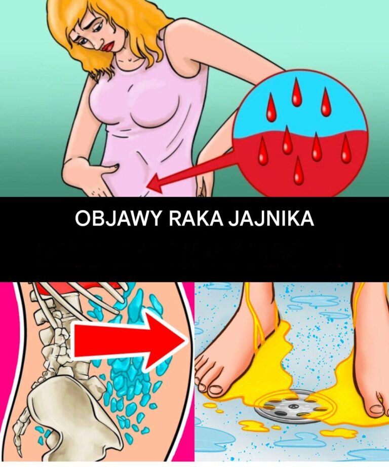 Zwi_zek_mi_dzy_rakiem_jajnika_a_rakiem_piersi__co_ka_da_kobieta_powinna_wiedzie_