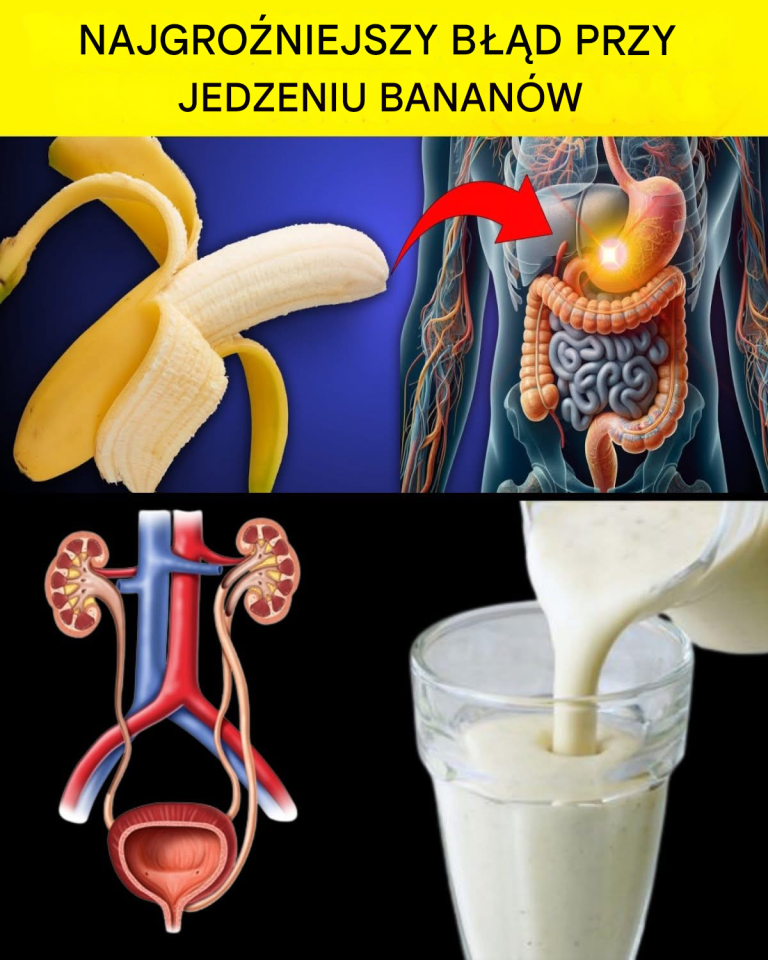 8_powa_nych_b__d_w__kt_re_pope_niasz_jedz_c_banany___przesta__ju__teraz_