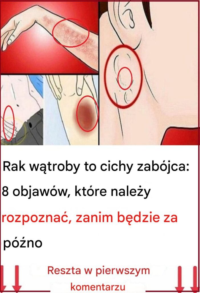 8_sygna__w_ostrzegawczych___e_Twoja_w_troba_jest_pe_na_toksyn_i_powoduje_przybieranie_na_wadze 8_sygna__w_ostrzegawczych___e_Twoja_w_troba_jest_pe_na_toksyn_i_powoduje_przybieranie_na_wadze