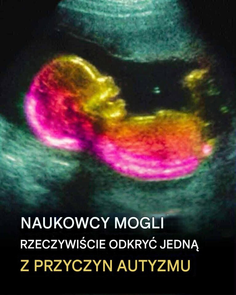 Badanie_identyfikuje_mo_liwe_powi_zanie_z_rozwojem_autyzmu