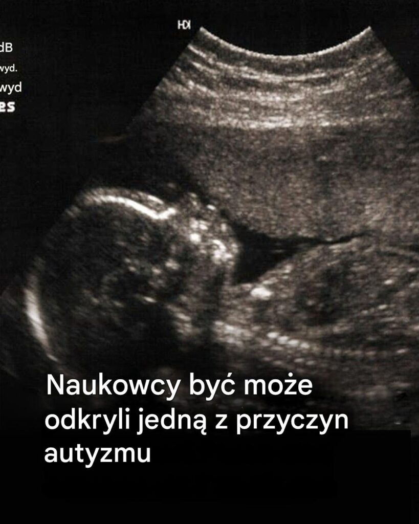 Bardzo_interesuj_ce_ Bardzo_interesuj_ce_