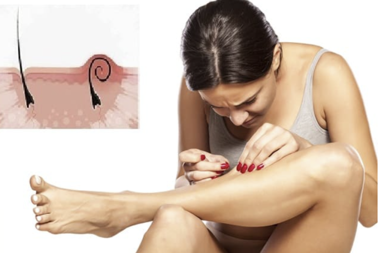 Ca_e_jej_cia_o_sw_dzia_o__Lekarze_postawili_przera_aj_c__diagnoz___alergia_czy_pokrzywka_-1