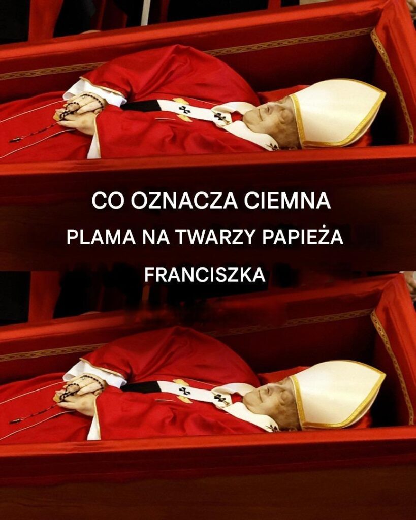 Co_to_za_ciemna_plama_wydana_na_twarz_papie_a_Franciszka__hipotezy_ekspert_w Co_to_za_ciemna_plama_wydana_na_twarz_papie_a_Franciszka__hipotezy_ekspert_w