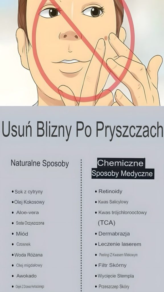 Jak_usun___blizn__po_pryszczu Jak_usun___blizn__po_pryszczu