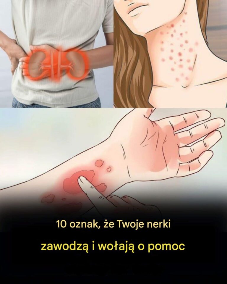 Je_li_Twoje_nerki_s__w_niebezpiecze_stwie__organizm_da_Ci_zna__tymi_10_znakami