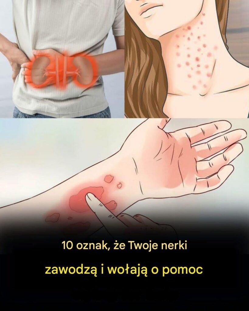 Je_li_Twoje_nerki_s__w_niebezpiecze_stwie__organizm_da_Ci_zna__tymi_10_znakami Je_li_Twoje_nerki_s__w_niebezpiecze_stwie__organizm_da_Ci_zna__tymi_10_znakami