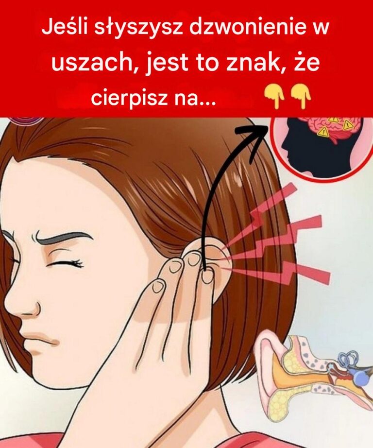 Je_li_s_yszysz_dzwonienie_w_uszach__jest_to_znak___e_cierpisz_na_