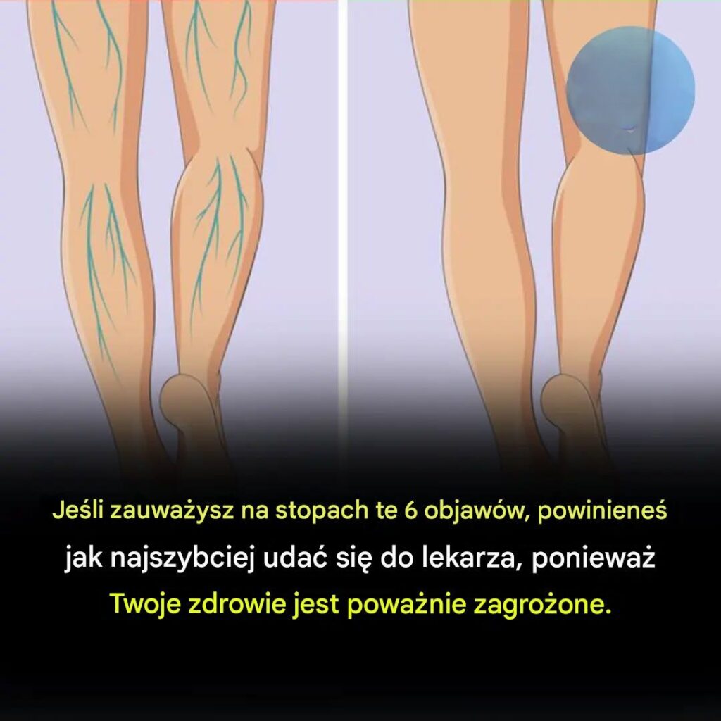 Je_li_zauwa_ysz_na_stopach_te_6_objaw_w__powiniene__jak_najszybciej_uda__si__do_lekarza__poniewa__Twoje_zdrowie_ma_powa_ne_problemy