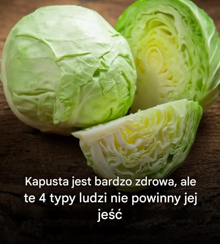 Kapusta__4_profile__dla_kt_rych_to_zdrowe_warzywo_staje_si__zagro_eniem
