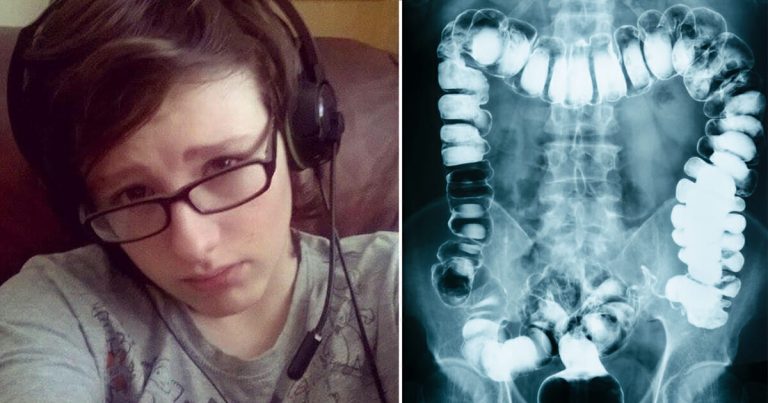 Lekarze_zdiagnozowali_u_nastolatka_zaparcie__zmar__24_godziny_p__niej-1