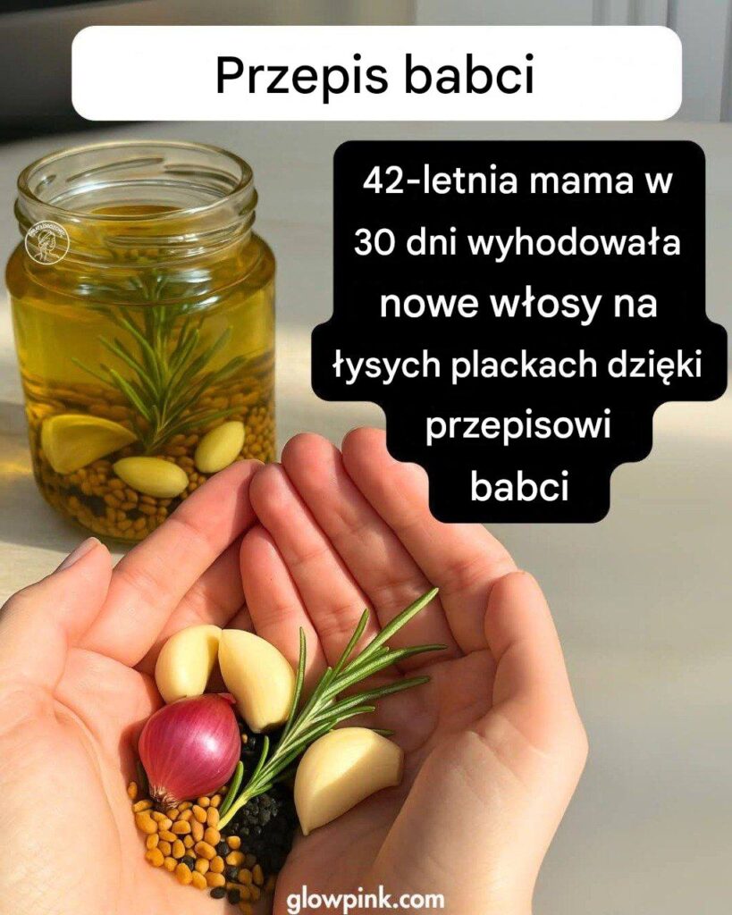 Najlepszy_zio_owy_olejek_do_w_os_w__lekarstwo_na_wszystkie_problemy_z_w_osami Najlepszy_zio_owy_olejek_do_w_os_w__lekarstwo_na_wszystkie_problemy_z_w_osami