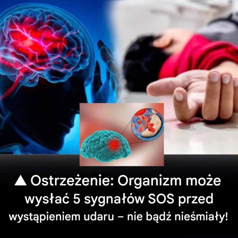 Ostrze_enie__Organizm_mo_e_wys_a__pi___sygna__w_SOS_przed_udarem___nie_ignoruj___ich
