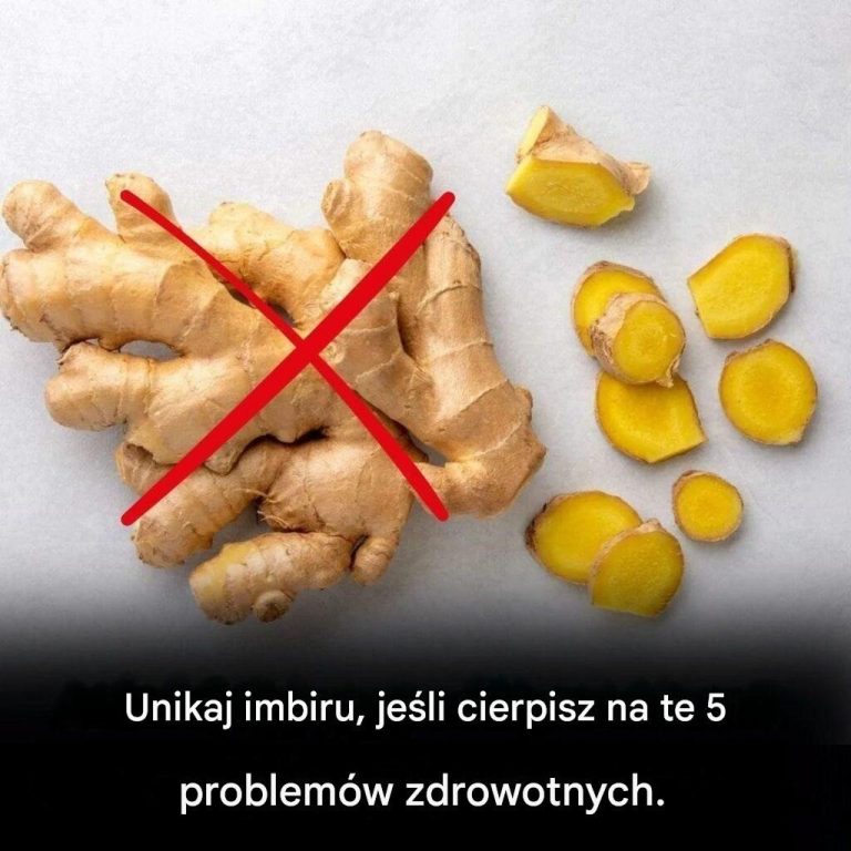 Unikaj_imbiru__je_li_masz_te_5_problem_w_zdrowotnych_-2