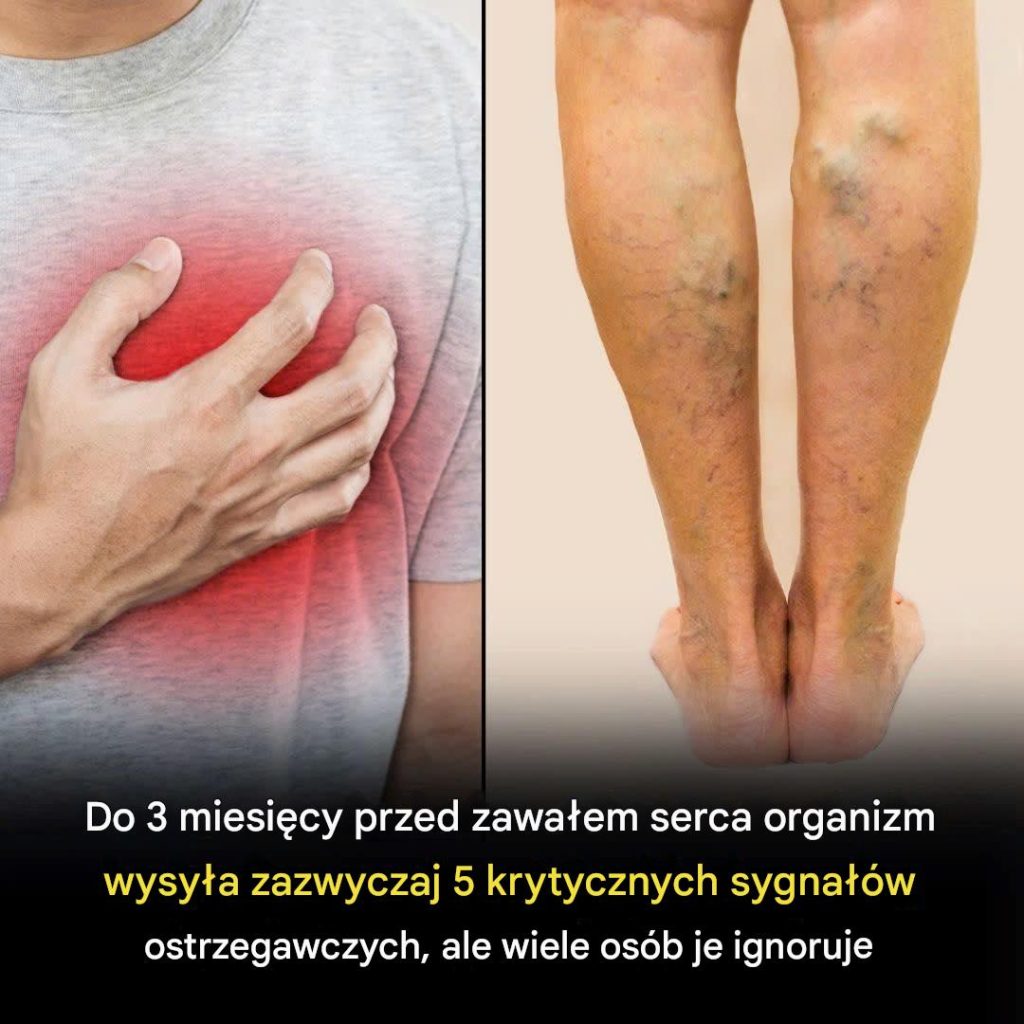 Zawa_y_serca_zdarzaj__si__rzadko_i_nagle___5_sygna__w_ostrzegawczych__kt_re_mog__pojawi__si__nawet_3_miesi_ce_wcze_niej