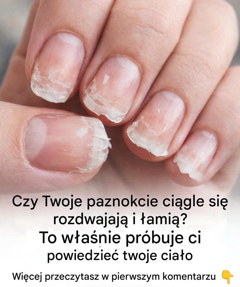 amliwe_lub_kruche_paznokcie__co_pr_buje_Ci_powiedzie__Twoje_cia_o