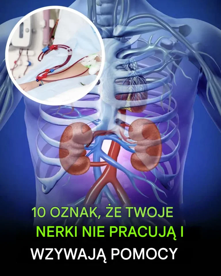 10_niepokoj_cych_objaw_w_wskazuj_cych_na_dysfunkcj__nerek