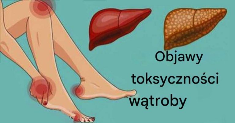 11_oznak___e_Twoja_w_troba_nie_pracuje_prawid_owo_i_w_Twoim_organizmie_gromadz__si__toksyny