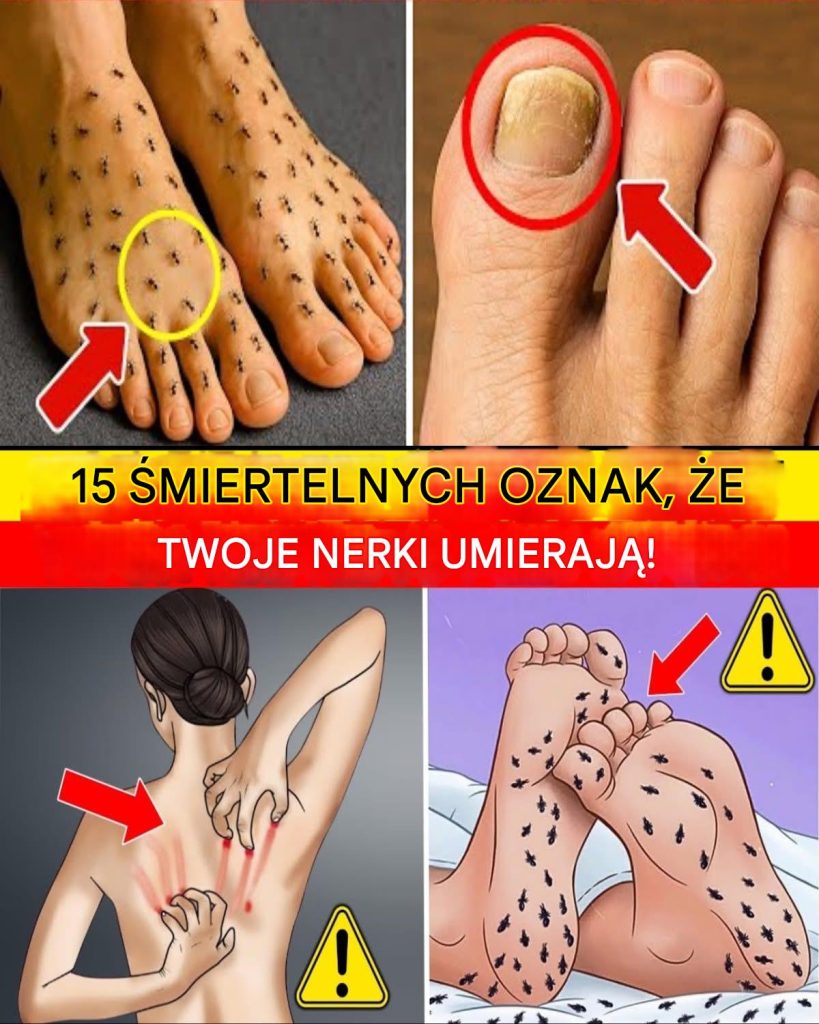 15__miertelnych_sygna__w_ostrzegawczych_dotycz_cych_nerek__kt_re_wi_kszo___ludzi_ignoruje__dop_ki_nie_jest_za_p__no__wykryj_je_wcze_nie___chro__swoje_nerki_ 15__miertelnych_sygna__w_ostrzegawczych_dotycz_cych_nerek__kt_re_wi_kszo___ludzi_ignoruje__dop_ki_nie_jest_za_p__no__wykryj_je_wcze_nie___chro__swoje_nerki_