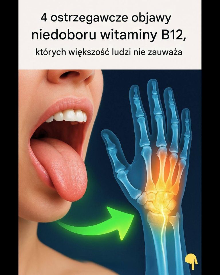 4_niepokoj_ce_objawy_niedoboru_witaminy_B12__kt_rych_nie_mo_esz_ignorowa__