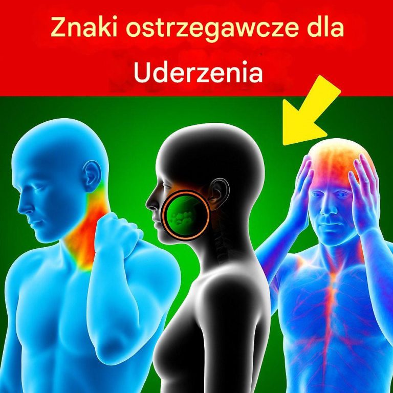 7_objaw_w_udaru_m_zgu___co_musisz_wiedzie__