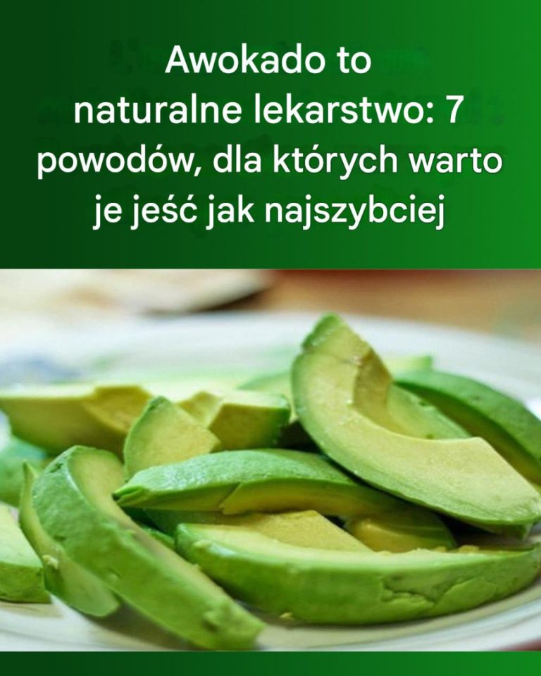 7_powod_w__dla_kt_rych_warto_je___awokado_______