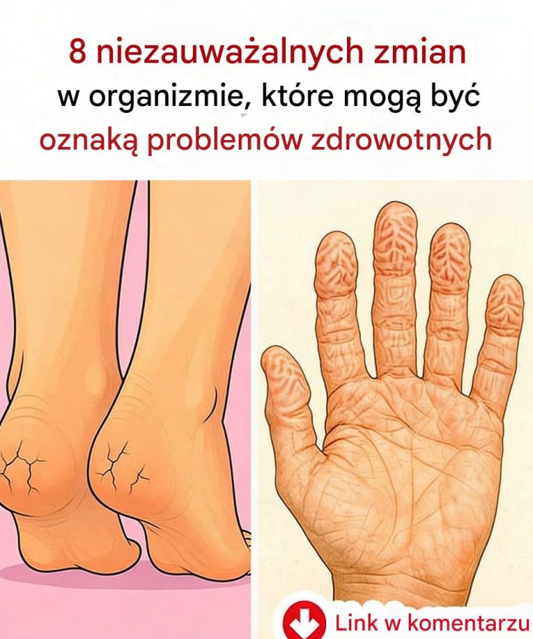 8_niezauwa_alnych_zmian_w_organizmie__kt_re_mog__by__oznak__problem_w_zdrowotnych
