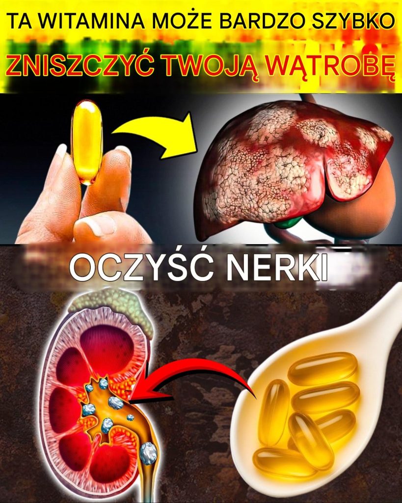 9_popularnych_suplement_w__kt_re_mog__powa_nie_zaszkodzi__Twojej_w_trobie_i_nerkom__oraz_4_ukryte_sk_adniki__kt_rych_nale_y_unika__jak_trucizny_ 9_popularnych_suplement_w__kt_re_mog__powa_nie_zaszkodzi__Twojej_w_trobie_i_nerkom__oraz_4_ukryte_sk_adniki__kt_rych_nale_y_unika__jak_trucizny_