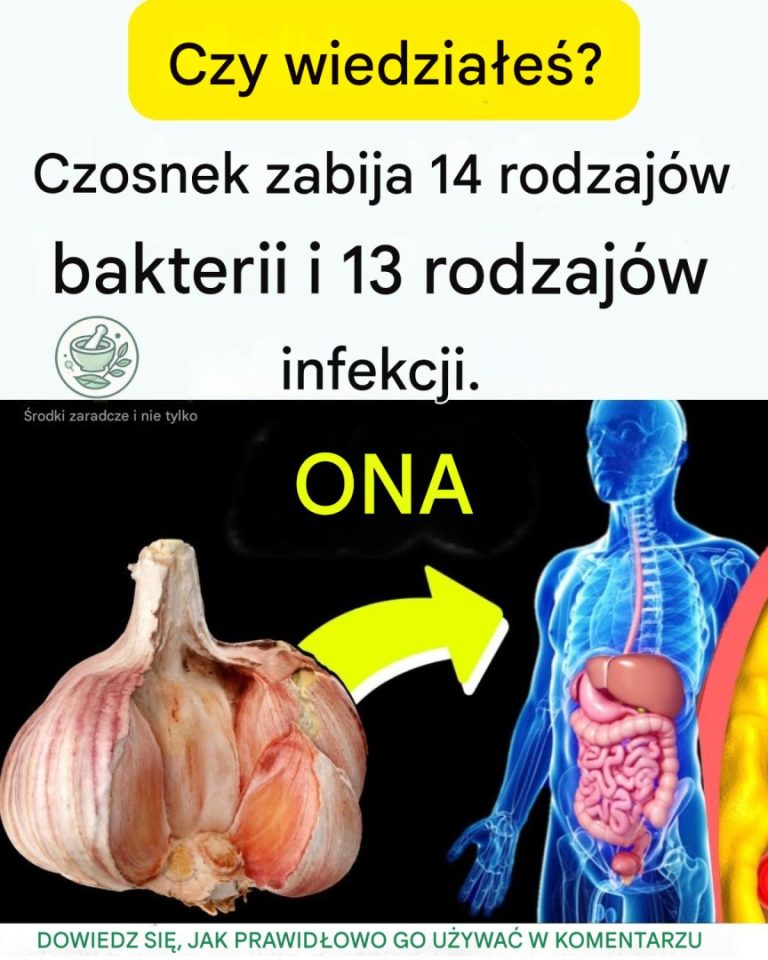 Czosnek__naturalny_antybiotyk_zwalczaj_cy_bakterie_i_infekcje