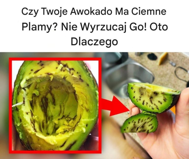 Czy_Twoje_Awokado_Ma_Ciemne_Plamy__Nie_Wyrzucaj_Go__Oto_Dlaczego______