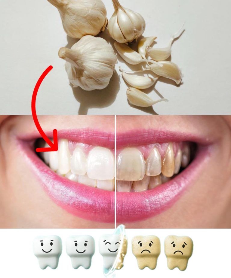 Denty_ci_b_d__zniesmaczeni__gdy_us_yszysz___e_znasz_ten_trik__jak_szybko_usun___kamie__naz_bny_i_wybieli__z_by_w_domu_