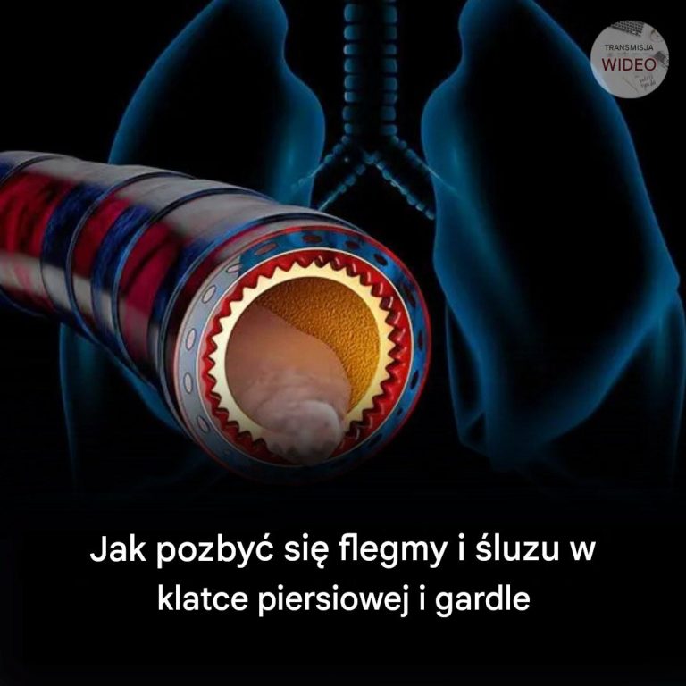 Jak_pozby__si__flegmy_i__luzu_w_klatce_piersiowej_i_gardle