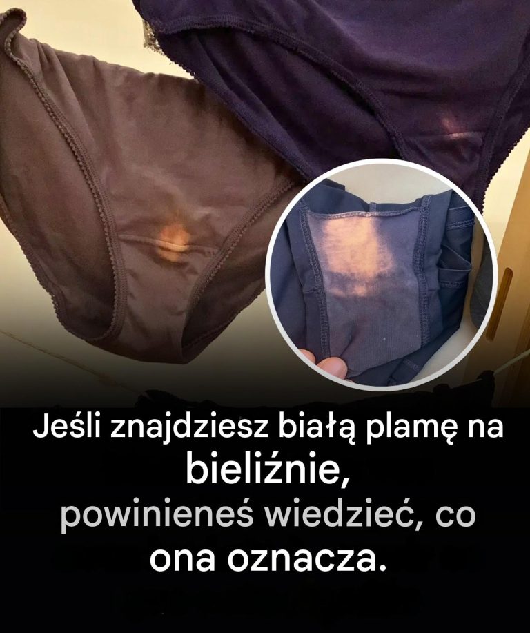 Je_li_znajdziesz_bia___plam__na_bieli_nie__powiniene__wiedzie___co_ona_oznacza_