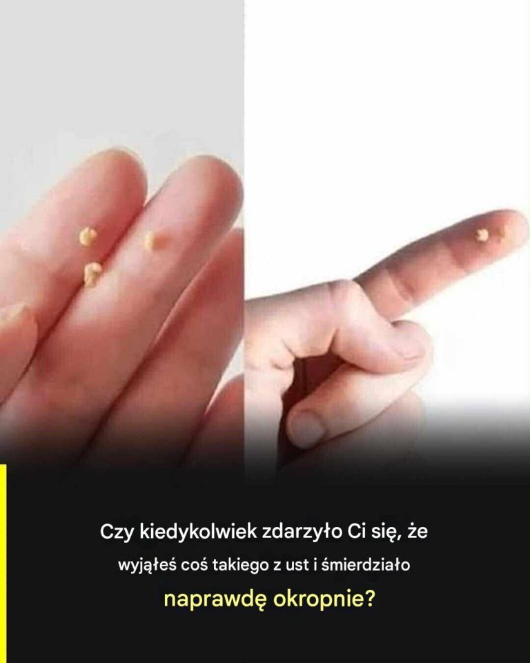 Kamienie_gard_owe__kt_rych_nikt_si__nie_spodziewa__czym_s__kamienie_migda_kowe_i_jak_si__ich_pozby_