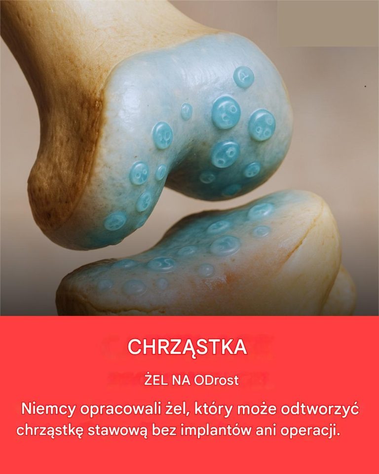 Koniec_z_b_lem_staw_w___el_w_Niemczech_mo_e_by__prze_omem_w_przypadku_chrz_stki