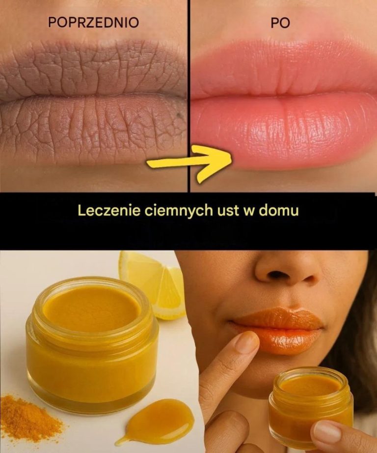 Leczenie_ciemnych_ust_w_domu