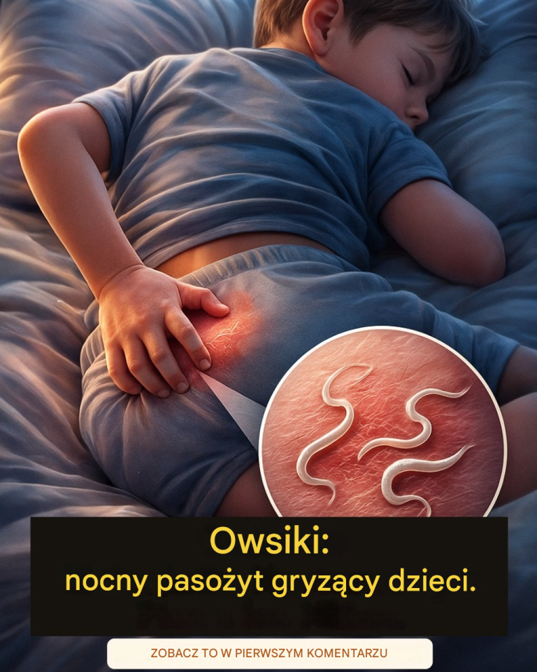 Owsiki_u_dzieci__czym_s__i_dlaczego_powoduj__sw_dzenie_w_nocy_-1