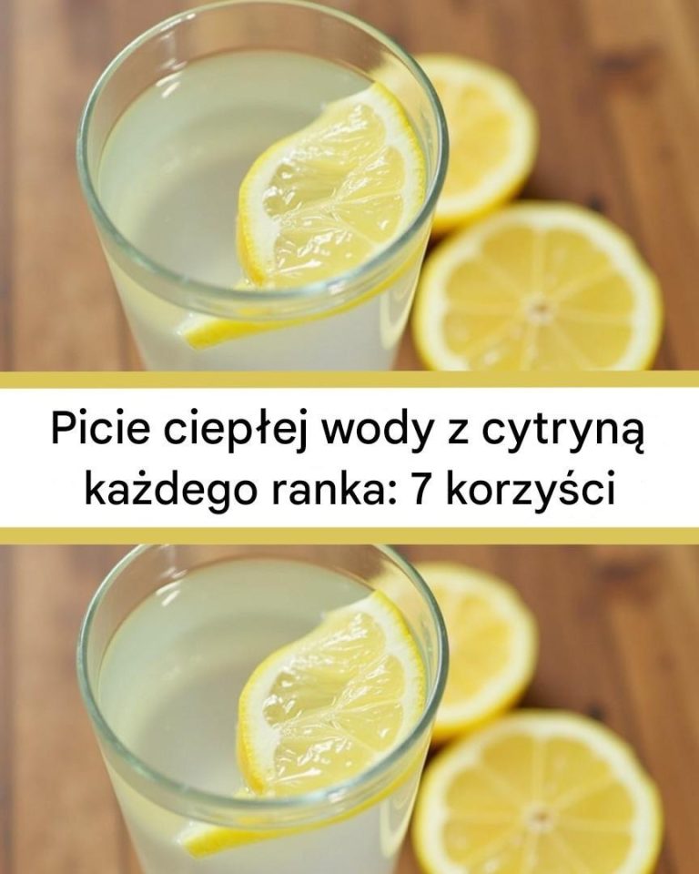 Picie_ciep_ej_wody_z_cytryn__ka_dego_ranka__7_korzy_ci__kt_re_zmieni__Twoj__rutyn_
