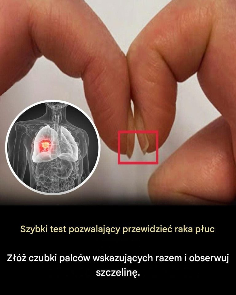 Prosty_test_palca_zalecany_przez_lekarzy___szybki_spos_b_na_sprawdzenie_zdrowia_